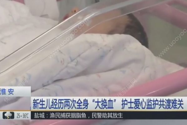 新生儿患上溶血症，经历了两次全身“大换血”，溶血症的症状(1)