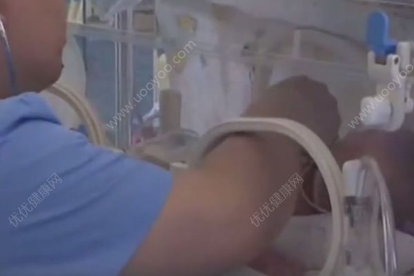 新生儿患上溶血症，经历了两次全身“大换血”，溶血症的症状(4)