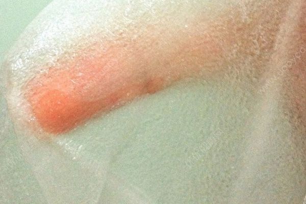 冬天面膜可以温水泡吗？冬天面膜用温水泡多久？(4)