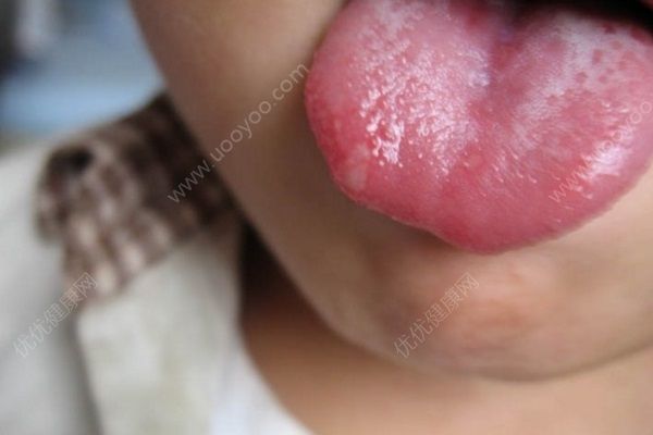 西安一幼儿园多人感染手足口病，家长质疑园方隐瞒(3)