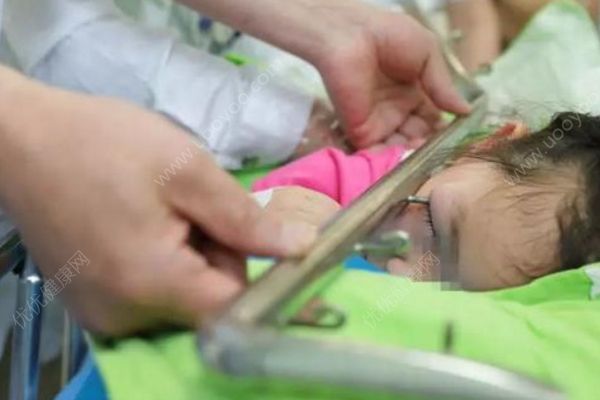 3岁女童被铁钩戳进眼睛，带着一截钢管送医(1)