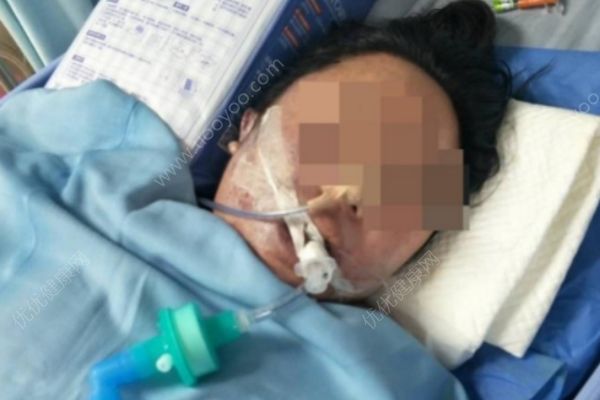女子1天连做3项整形手术，次日陷入昏迷6天后身亡(1)