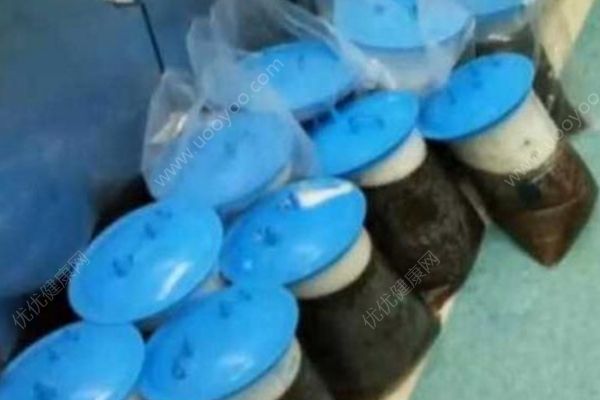 69岁大妈患妇科肿瘤肚鼓如球，医生抽出30多升囊液(3)