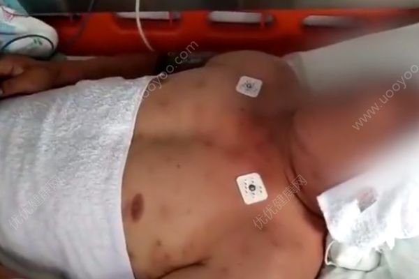 开车时遭蜂群突袭，男子为救妻儿只身引开蜜蜂(1)