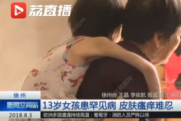 女孩患罕见病最怕热，家贫买不起空调只靠奶奶背起来回走(4)