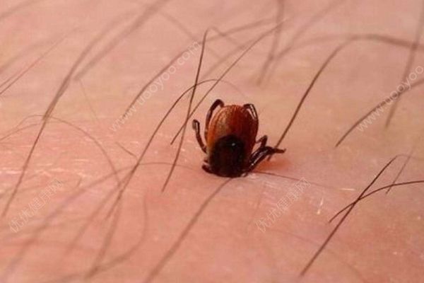 一家四人感染新型布尼亚病毒两人去世，或因蜱虫叮(1)