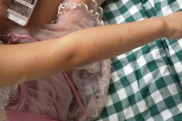 6岁女孩吃完药后接连呕吐！一查竟开错了8倍剂量！(2)
